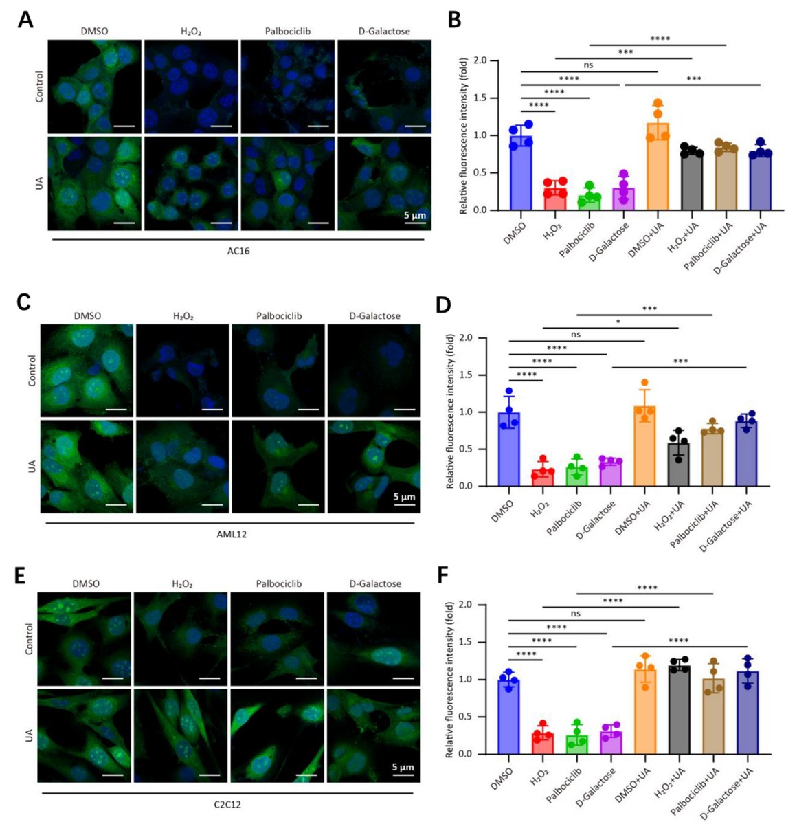 MitoIgnite® restoring HPG-labelled nascent protein synthesis in AC16, AML12 and C2C12 cell models: fluorescence images and quantification